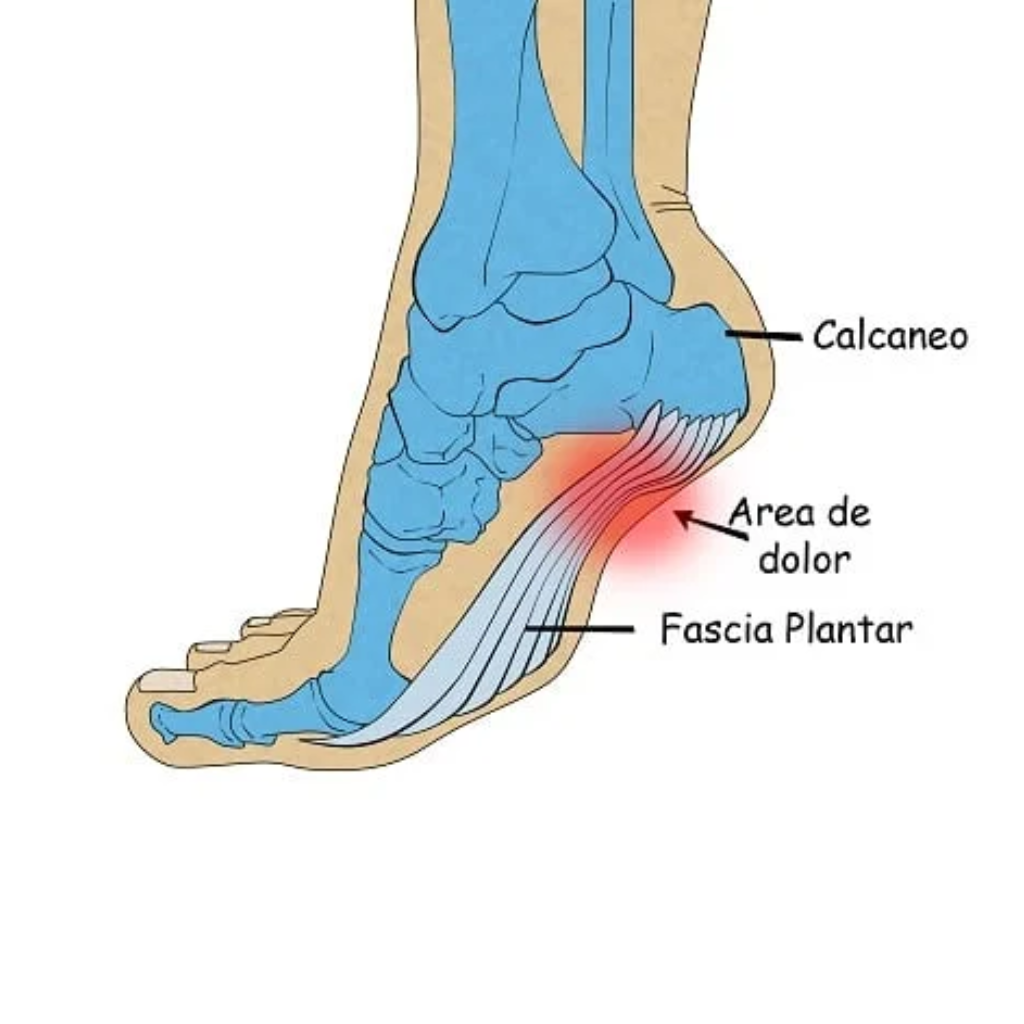 TalonCare - Alivia Tu Dolor En Segundos!